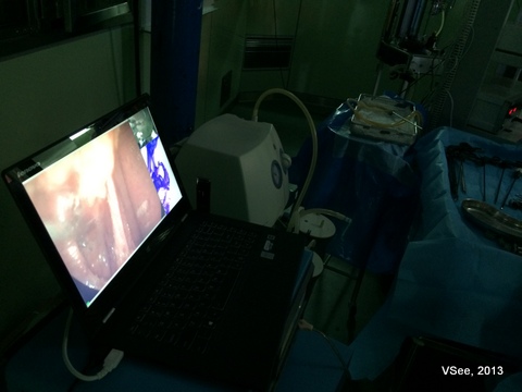 laparoscopic surgery on VSee 