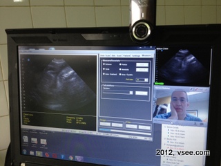 VSee remote ultrasound