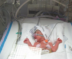 neonatal in NICU